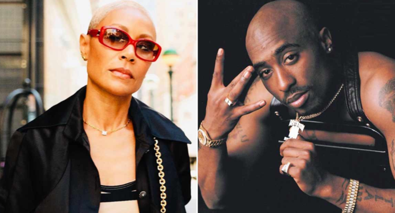 jada and tupac, Alopecia